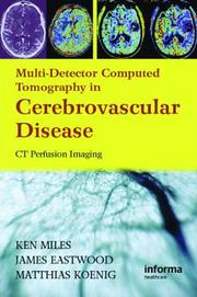 Cover of: Multidetector Computed Tomography in Cerebrovascular Disease: CT Perfusion Imaging