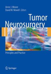 Cover of: Tumor Neurosurgery: Principles and Practice (Springer Specialist Surgery Series)