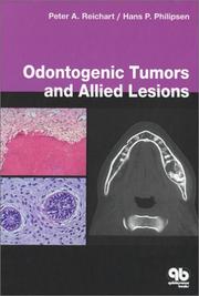 Odontogenic tumors and allied lesions by P. Reichart, Peter A. Reichart, Hans Peter Philipsen