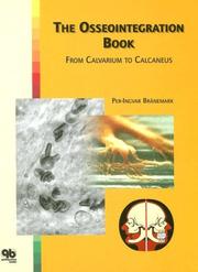 Cover of: Osseointegration Book | Per-Ingvar Branemark