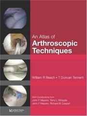 Atlas of arthroscopic techniques by William R. Beach, T. Duncan Tennent, Richard B. Caspari, John F. Meyers, Terry I. Whipple