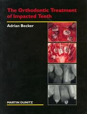 Cover of: The Orthodontic Treatment of Impacted Teeth by A. Becker, Adrian Becker