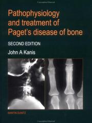 Pathophysiology and treatment of Paget's disease of bone by John A. Kanis