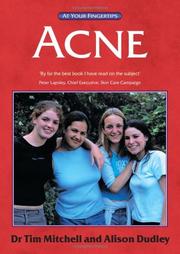 Cover of: Acne: The 'At Your Fingertips' Guide (At Your Fingertips)