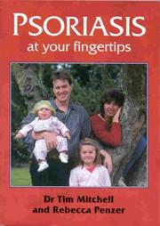 Cover of: Psoriasis at Your Fingertips (At Your Fingertips)