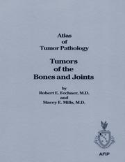 Cover of Tumors Of The Bones & Joints (Atlas of Tumor Pathology (AFIP) 3rd Series)
