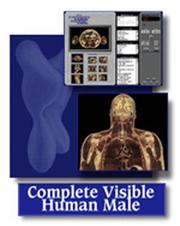 Complete Visible Male - Complete Package (COMPLETE VISIBLE HUMAN MALE 2, THE) by SPITZER