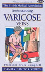 Understanding Varicose Veins (Family Doctor) by Bruce Campbell