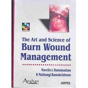 Cover of: The Art & Science of Burn Wound Management | Marella L., M.D. Hanumadass