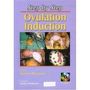 Cover of: Step by Step Ovulation Induction by Surveen Ghuman