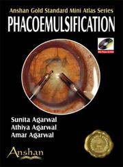 Cover of: Mini Atlas of Phacoemulsification (Anshan Gold Standard Mini Atlas) (Anshan Gold Standard Mini Atlas) (Anshan Gold Standard Mini Atlas) (Anshan Gold Standard Mini Atlas)