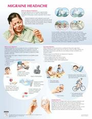 Cover of: Migraine Chart (Netter Charts)