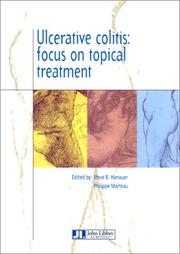 Cover of: Ulcerative Colitis: Focus on Topical Treatment