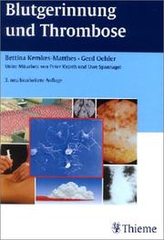 Bettina Kemkes-Matthes (Autor), Gerd Oehler (Autor), Peter Kujath (Autor), Uwe Spannagel (Autor) - Blutgerinnung und Thrombose