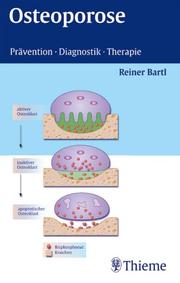 Cover of: Osteoporose. Prävention, Diagnostik, Therapie.