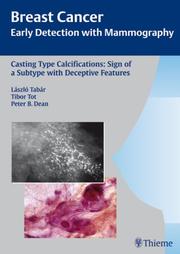Cover of: Casting Type Calcifications by Laszlo Tabar