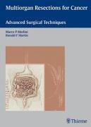 Cover of: Multiorgan Resections for Cancer: Advanced Surgical Techniques