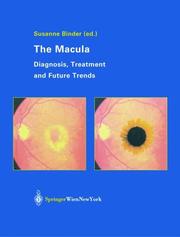 The Macula by Susanne Binder