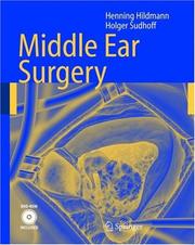 Cover of: Middle Ear Surgery