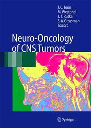 Cover of: Neuro-Oncology of CNS Tumors