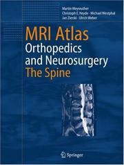 Cover of: MRI Atlas: Orthopedics and NeurosurgeryThe Spine