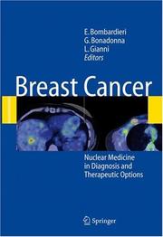 Cover of: Breast Cancer: Nuclear Medicine in Diagnosis and Therapeutic Options