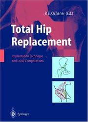 Cover of: Total Hip Replacement: Implantation Techniques and Local Complications