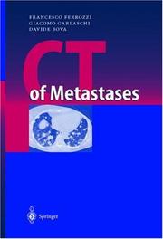 Cover of: Ct Of Metastases