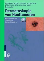 Cover of: Dermatoskopie von Hauttumoren: Auflichtmikroskopie - Dermoskopie - Digitale Bildanalyse