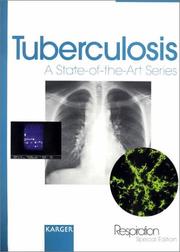 Cover of: Tuberculosis (States-of-the-Art Series)