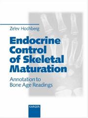 Endocrine Control of Skeletal Maturation by Ze'ev Hochberg