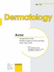 Cover of: Acne: Symposium at the World Congress of Dermatology, Paris, July 2002 (Dermatology)