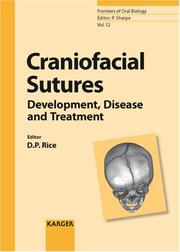 Cover of: Craniofacial Sutures by D. Rice