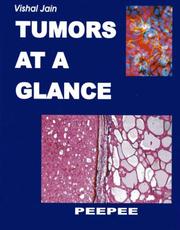 Cover of: Tumors at a Glance by Vishal Jain