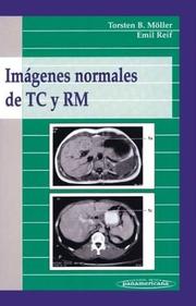 Cover of: Imagenes Normales de Tc y Rm