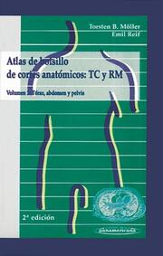Cover of: Atlas de Bolsillo de Cortes Anatomicos Tc y Rm Volumen 2