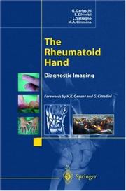 Cover of: Rheumatoid Hand by Giacomo Garlaschi