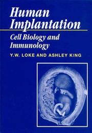 Cover of: Human Implantation by Y. W. Loke, Ashley King