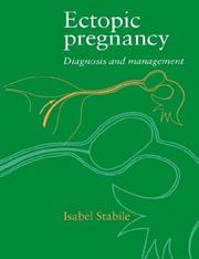 Cover of: Ectopic pregnancy by Isabel Stabile