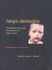 Cover of: Atopic Dermatitis by Hywel C. Williams