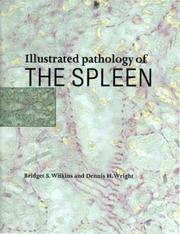 Cover of: Illustrated Pathology of the Spleen by Bridget S. Wilkins, Dennis H. Wright