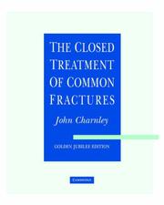 The Closed Treatment of Common Fractures by John Charnley
