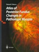 Cover of: Atlas of posterior fundus changes in pathologic myopia | Takashi Tokoro