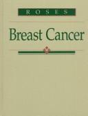 Cover of: Breast cancer by [edited by] Daniel F. Roses.