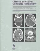 Cover of: Cerebral and spinal computed tomography