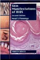 Cover of: Skin manifestations of AIDS by Neal S. Penneys