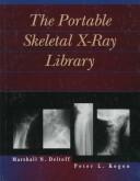Cover of: portable skeletal X-ray library | Marshall N. Deltoff
