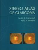 Cover of: Stereo atlas of glaucoma by Campbell, David G. M.D.