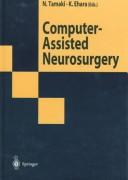 Computer-assisted neurosurgery by Norihiko Tamaki