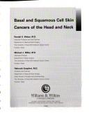 Cover of: Basal and squamous cell skin cancers of the head and neck by [edited by] Randal S. Weber, Michael J. Miller, Helmuth Goepfert.